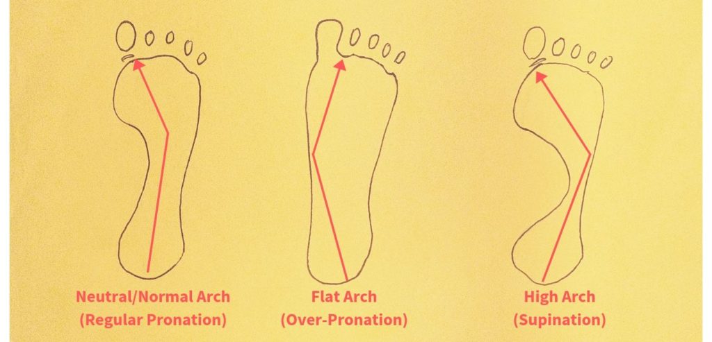 Foot imprint and arch types